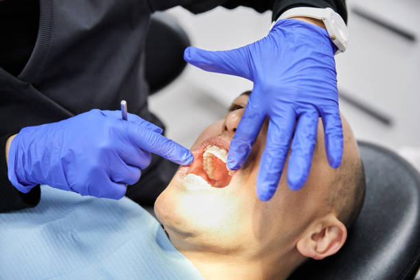 Best Root Canal Emergency Dentist  in Taylor Creek, OH